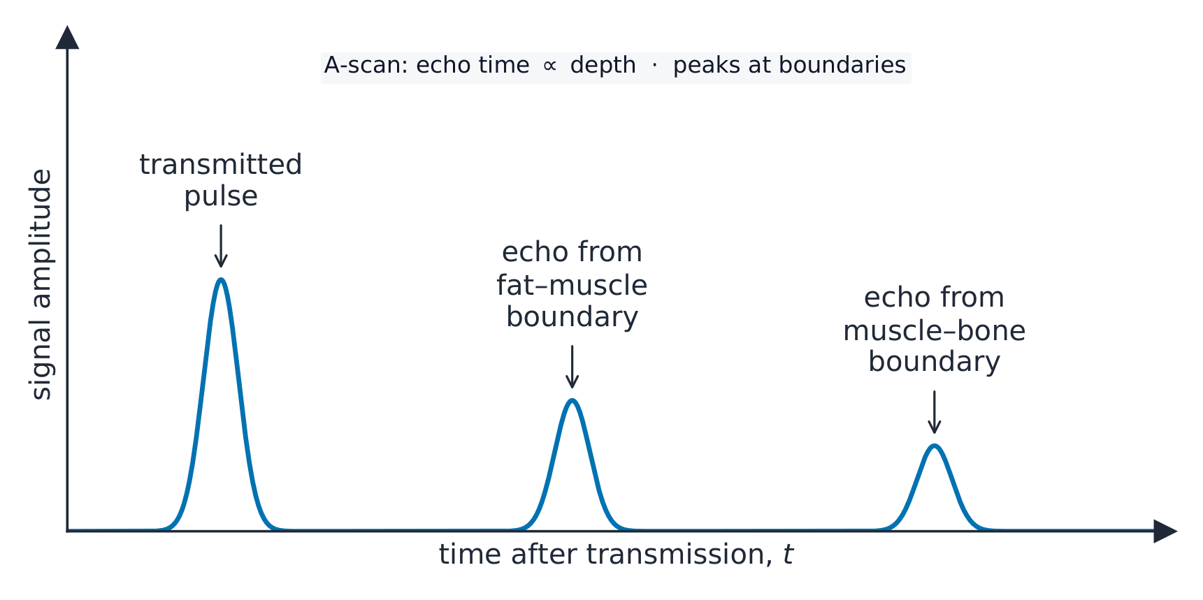 An A-scan trace on an oscilloscope: a large transmitted pulse, then smaller echo pulses from the fat–muscle boundary and the muscle–bone boundary at later times