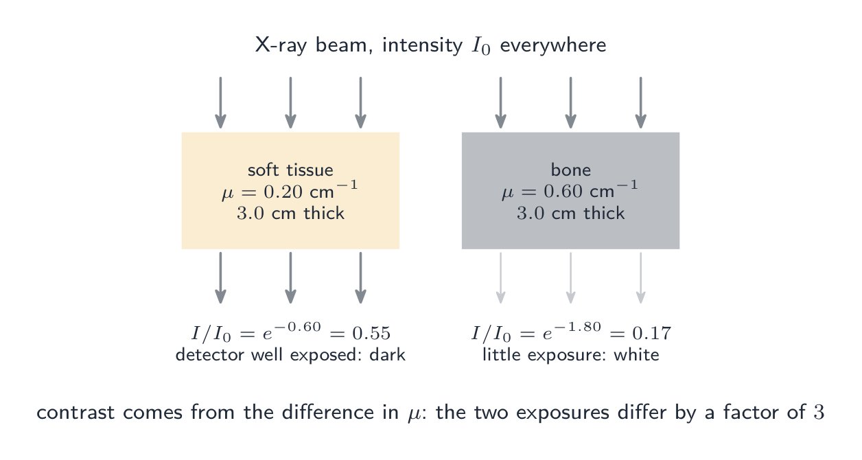 Bone attenuates about three times more strongly per centimetre than soft tissue, so equal thicknesses give very different exposures