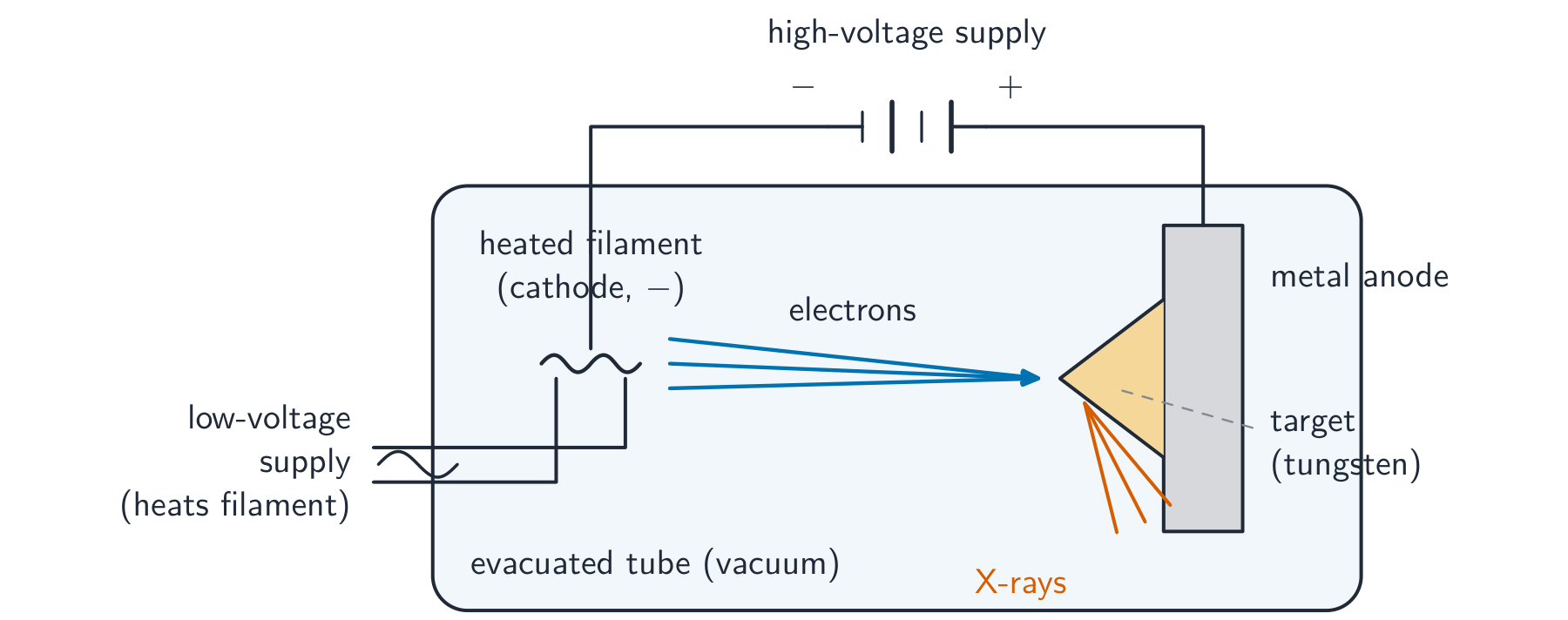 A diagram of an X-ray tube: a heated metal filament (cathode) driven by a low voltage, a high voltage accelerating electrons across an evacuated tube to a metal anode with an angled tungsten target, and X-rays leaving the target