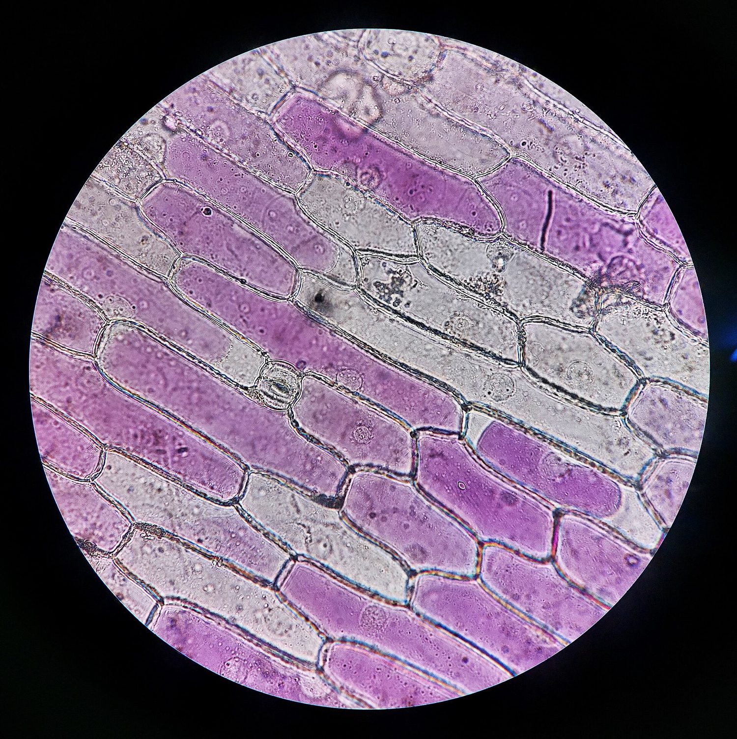 Red onion cells in hypertonic solution: the membrane pulls away from the wall (plasmolysis)
