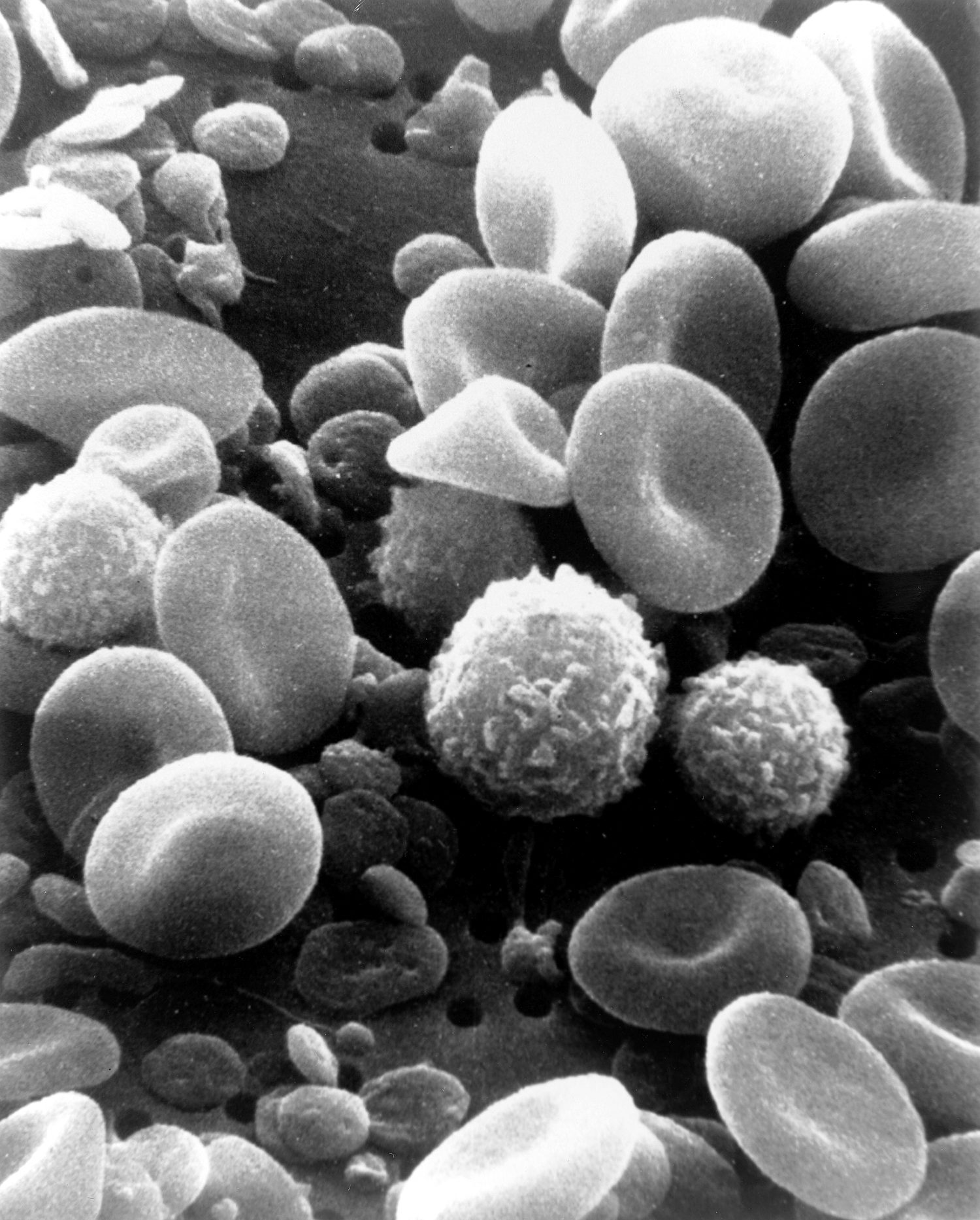Scanning electron micrograph of red blood cells — no nucleus, high surface area for gas exchange