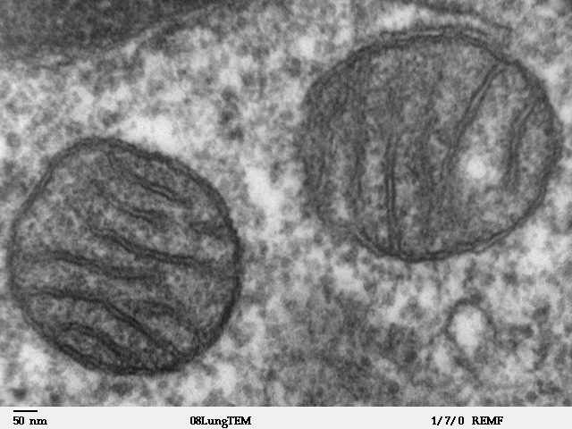 TEM of a mitochondrion: folded inner membrane (cristae) multiplies surface for respiration