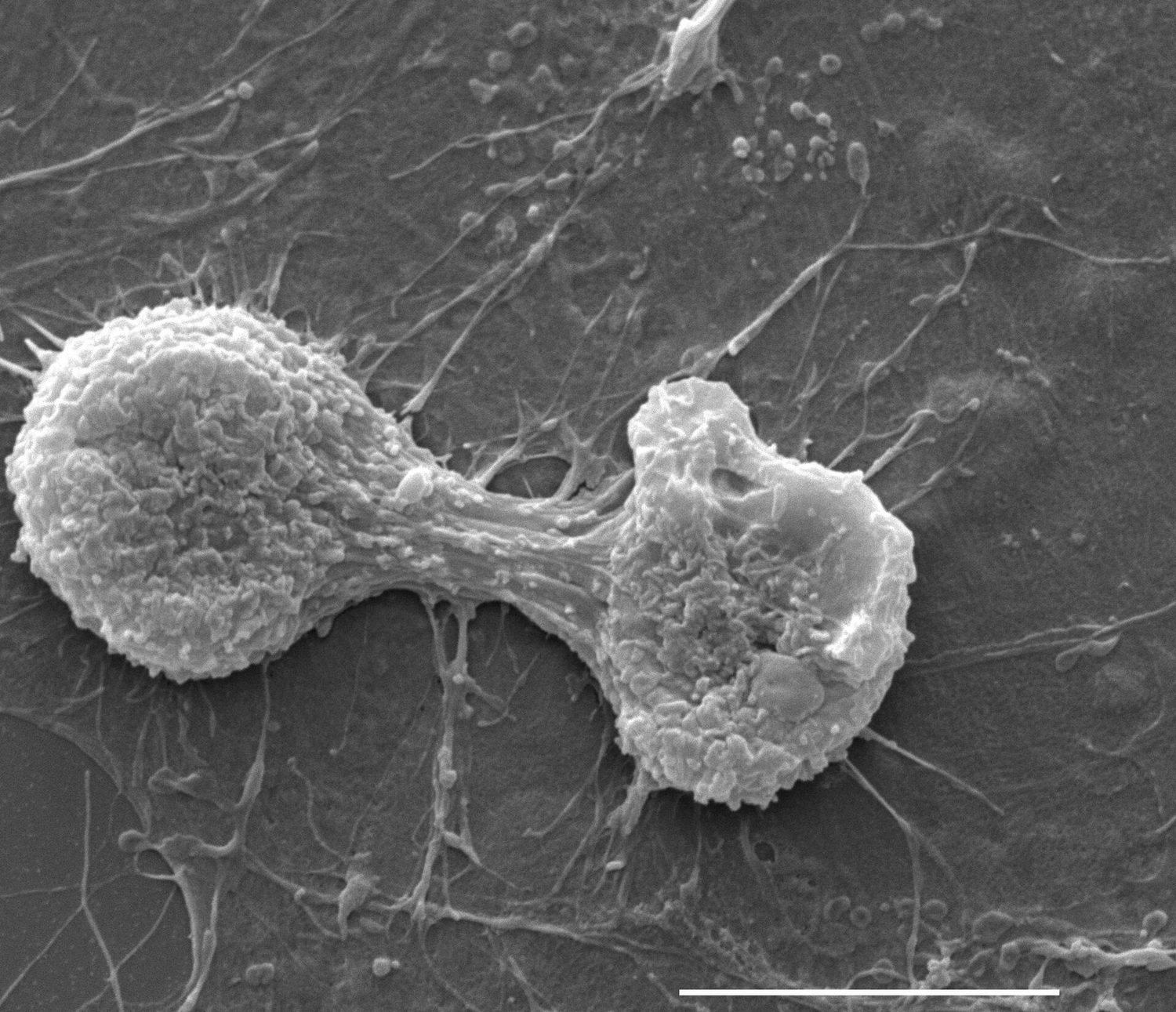 A fibroblast dividing: cytokinesis splits one cell into two after mitosis finishes