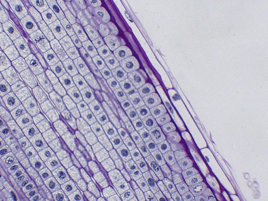 Onion root-tip cells at different stages of mitosis (light micrograph)