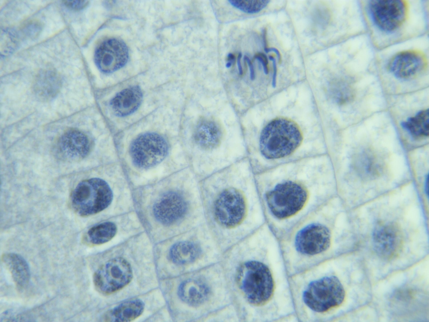 Onion root tip at metaphase: chromosomes line up before sister chromatids separate