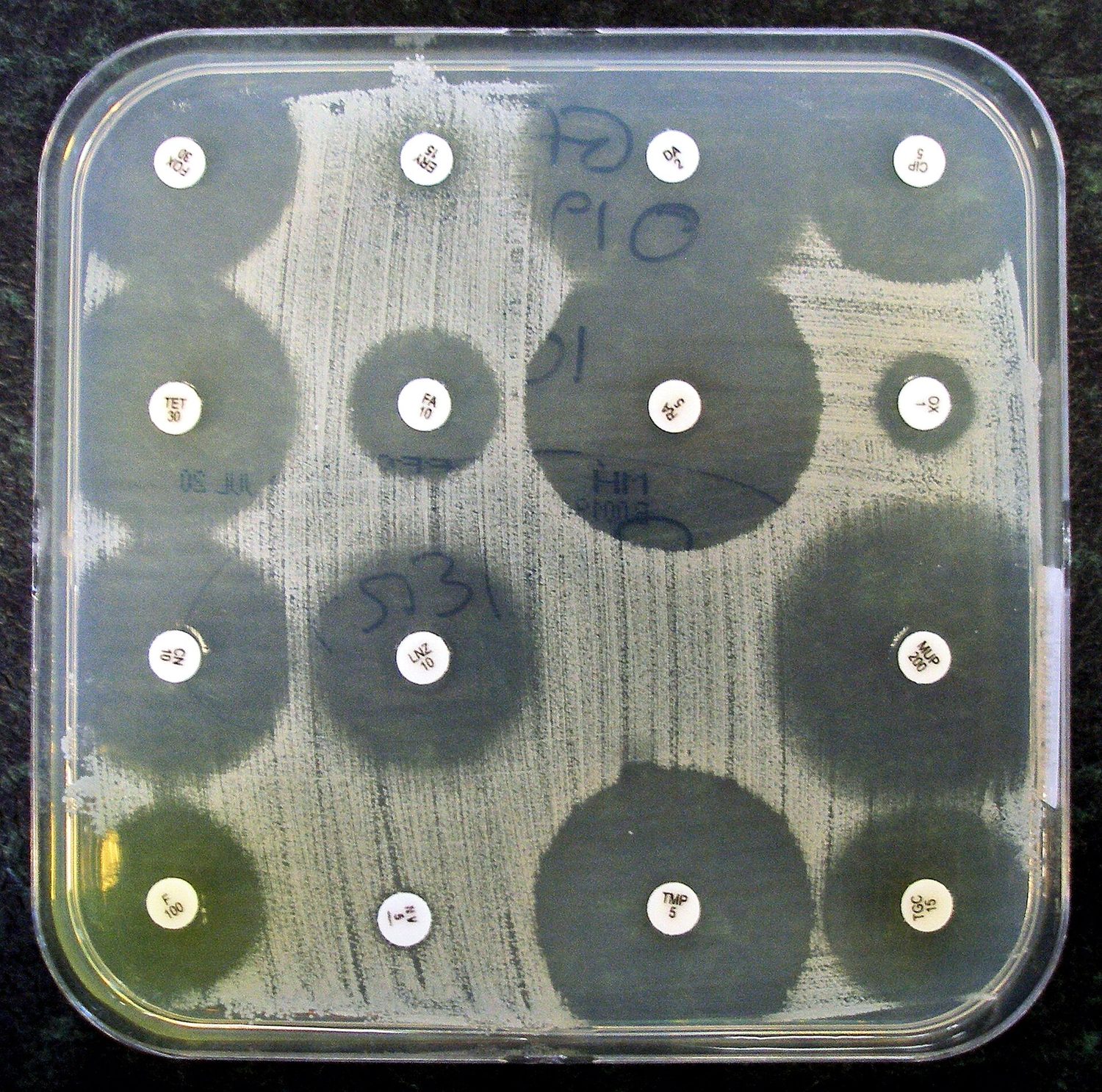 Antibiotic sensitivity plate: clear zones show which antibiotics kill the bacteria