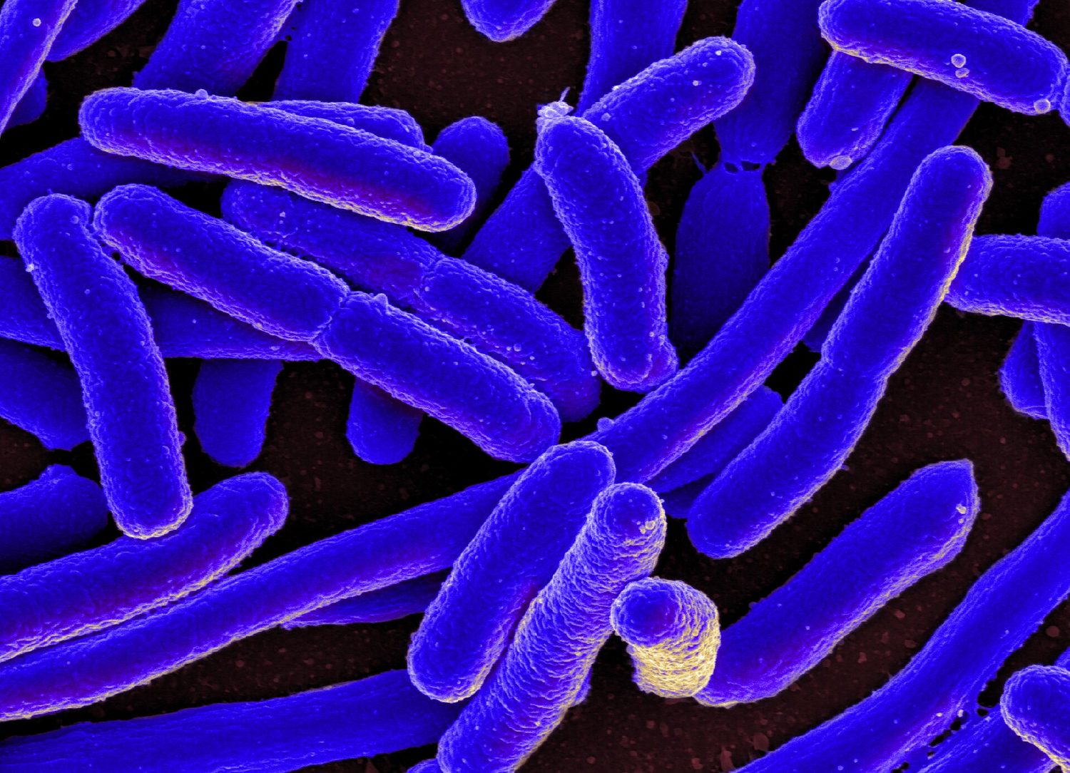 A prokaryote (bacterium): E. coli seen under an electron microscope