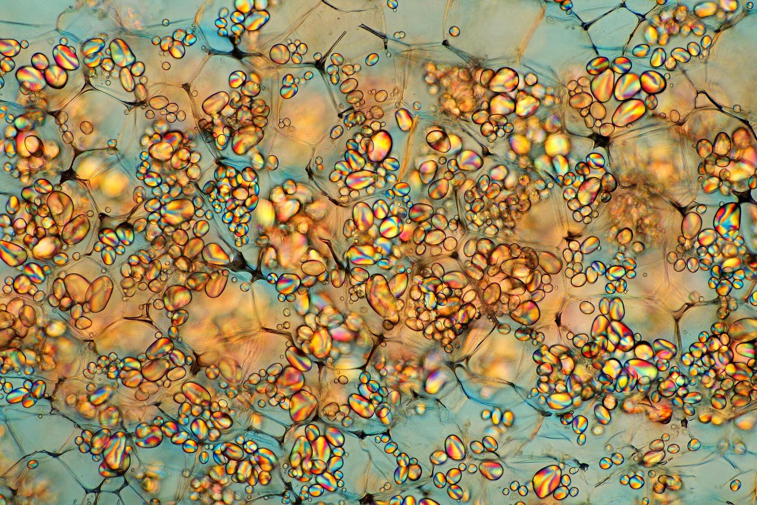 Starch grains from a potato, seen under a microscope