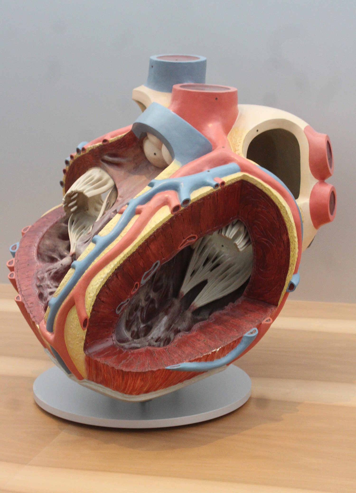 An anatomical model of a human heart cut open, showing the four chambers and the thick muscular wall of the left ventricle