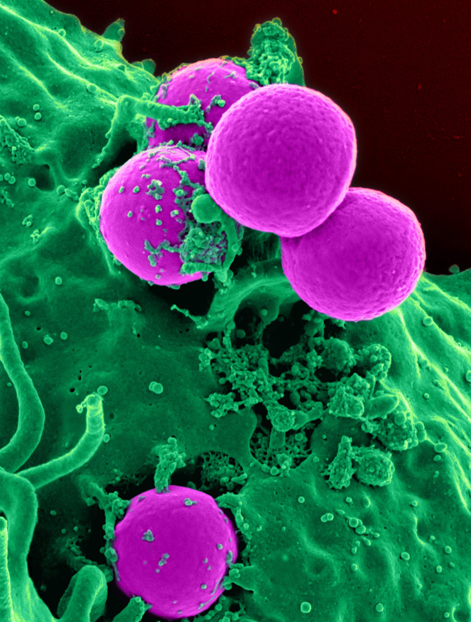 A white blood cell (green) engulfing round bacteria (purple), a key body defence