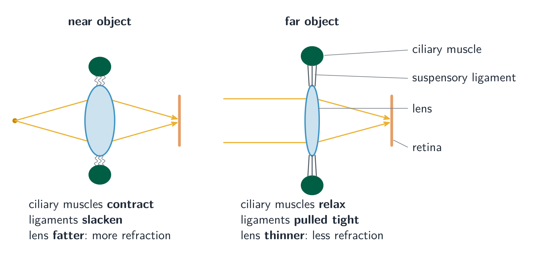Two side views of the lens: for a near object the rays spread out, the ciliary muscles have contracted, the suspensory ligaments are slack and the lens is fat; for a far object the rays are parallel, the ligaments are tight and the lens is thin; in both the rays meet on the retina