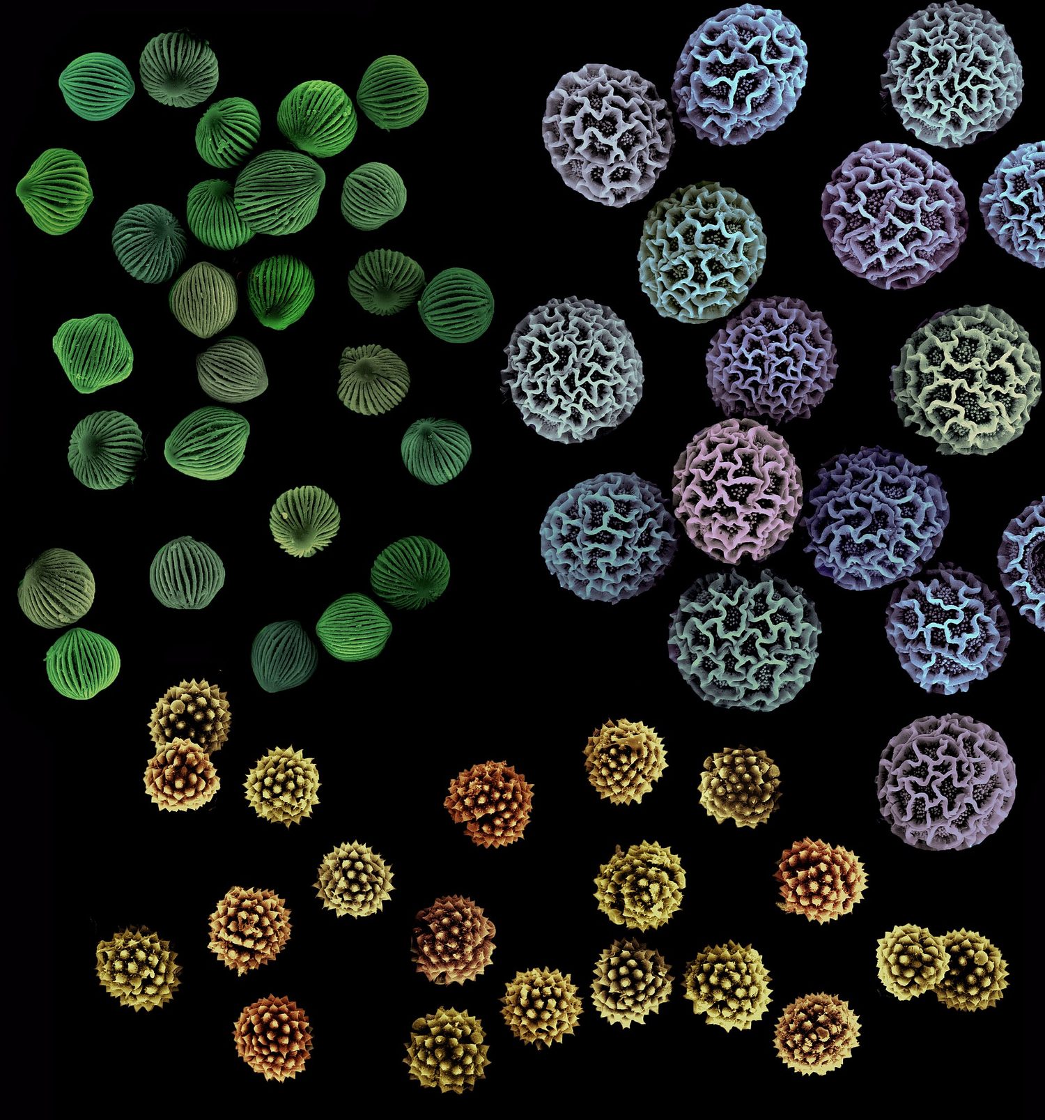 Pollen grains seen under an electron microscope, with spiky surfaces that catch on insects (colour added)