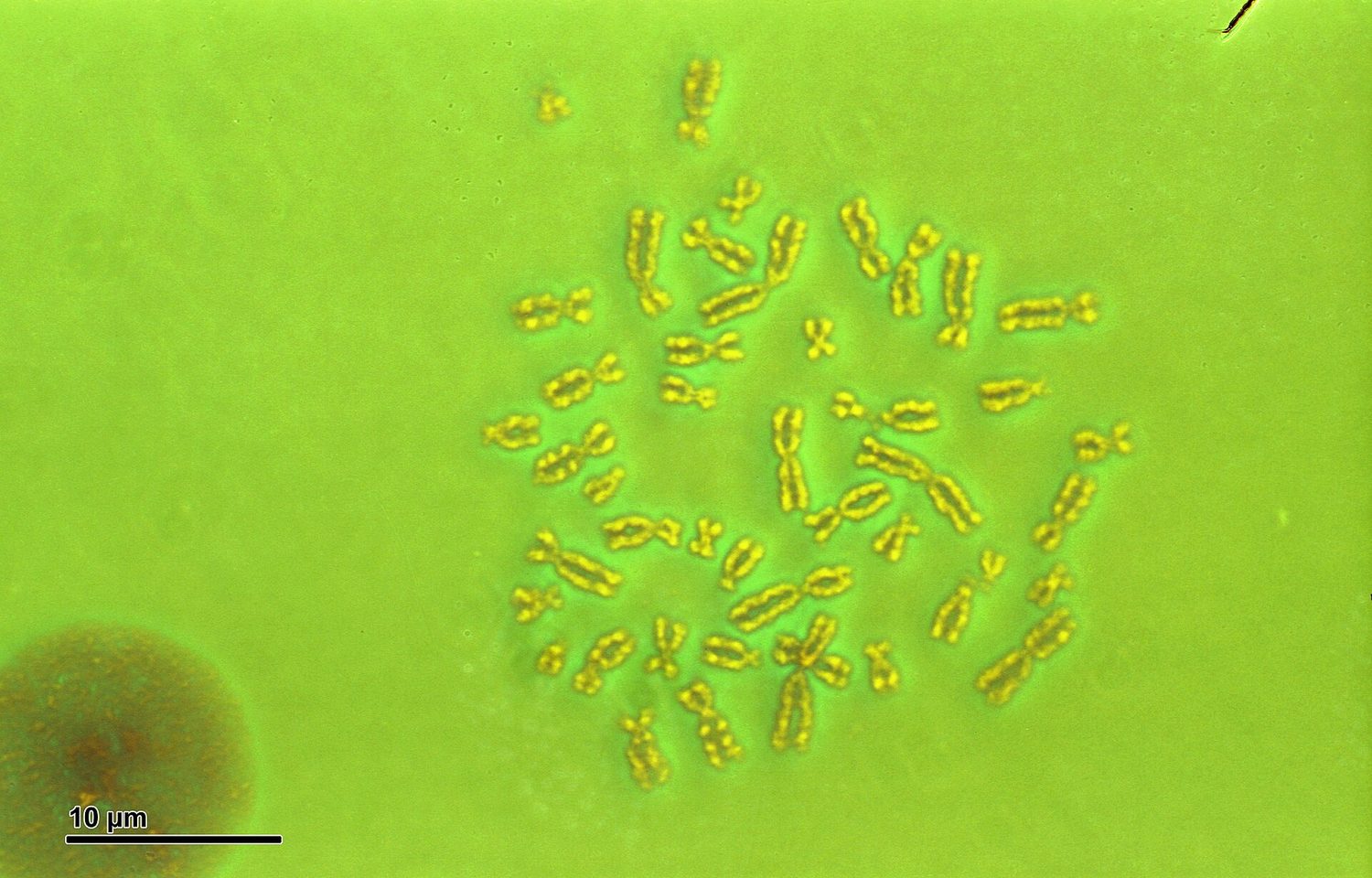 A human karyotype: 23 pairs of chromosomes, ending in XY for a male