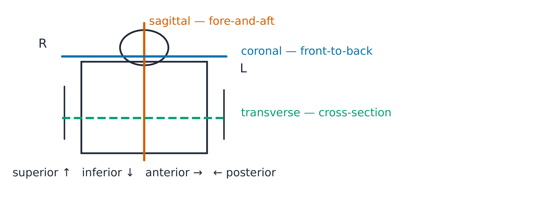 The three standard body planes on an anterior outline